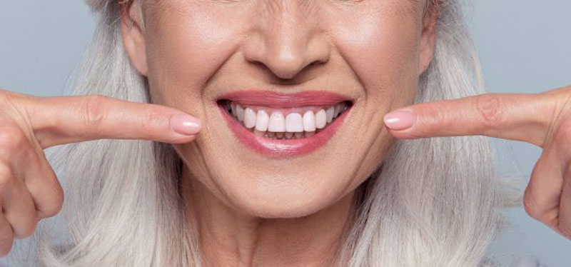 realizzazione impianti ai denti a Teramo